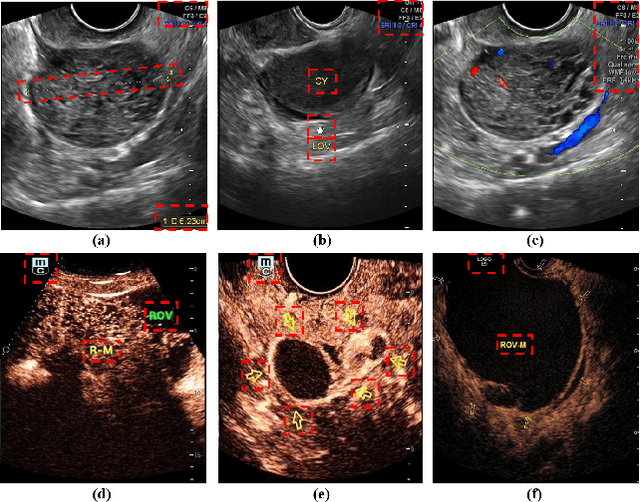 Figure 2 for A Multi-Modality Ovarian Tumor Ultrasound Image Dataset for Unsupervised Cross-Domain Semantic Segmentation