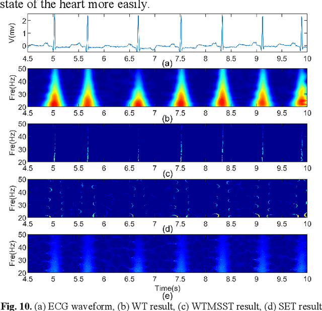 Figure 2 for An Energy-concentrated Wavelet Transform for Time Frequency Analysis of Transient Signals