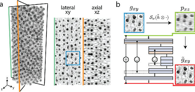 Figure 1 for Isotropic reconstruction of 3D fluorescence microscopy images using convolutional neural networks