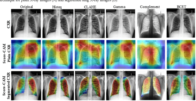 Figure 3 for Exploring the Effect of Image Enhancement Techniques on COVID-19 Detection using Chest X-rays Images