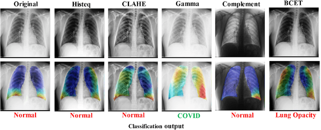 Figure 4 for Exploring the Effect of Image Enhancement Techniques on COVID-19 Detection using Chest X-rays Images