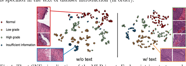 Figure 4 for TandemNet: Distilling Knowledge from Medical Images Using Diagnostic Reports as Optional Semantic References