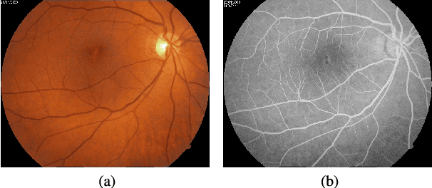 Figure 2 for Multimodal Transfer Learning-based Approaches for Retinal Vascular Segmentation