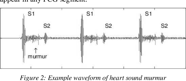 Figure 3 for Deep CardioSound-An Ensembled Deep Learning Model for Heart Sound MultiLabelling