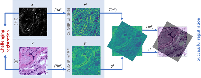 Figure 1 for CoMIR: Contrastive Multimodal Image Representation for Registration