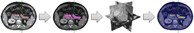 Figure 4 for DeepOrgan: Multi-level Deep Convolutional Networks for Automated Pancreas Segmentation