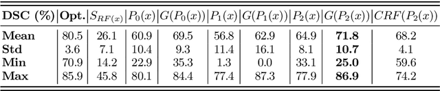 Figure 2 for DeepOrgan: Multi-level Deep Convolutional Networks for Automated Pancreas Segmentation