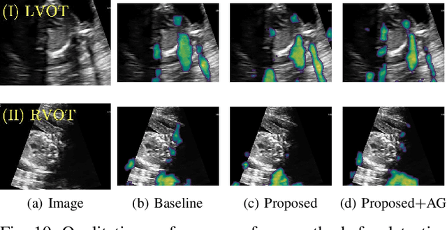Figure 2 for Weakly Supervised Estimation of Shadow Confidence Maps in Ultrasound Imaging
