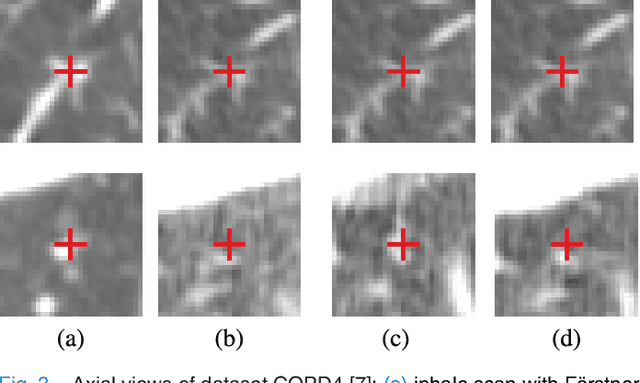 Figure 3 for Estimation of Large Motion in Lung CT by Integrating Regularized Keypoint Correspondences into Dense Deformable Registration