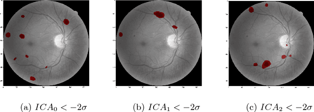 Figure 4 for Identification and Visualization of the Underlying Independent Causes of the Diagnostic of Diabetic Retinopathy made by a Deep Learning Classifier