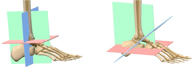 Figure 3 for Automatic Plane Adjustment of Orthopedic Intra-operative Flat Panel Detector CT-Volumes