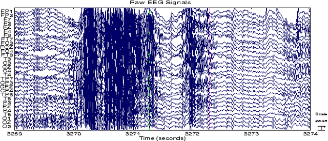 Figure 1 for Compressed Sensing for Energy-Efficient Wireless Telemonitoring: Challenges and Opportunities