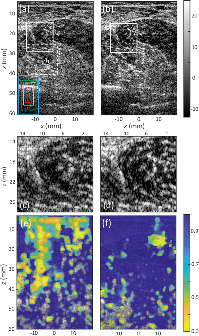 Figure 2 for Ultrasound Matrix Imaging. II. The distortion matrix for aberration correction over multiple isoplanatic patches