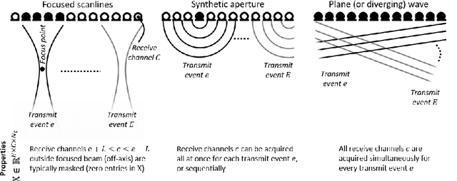 Figure 1 for Deep Learning for Ultrasound Beamforming