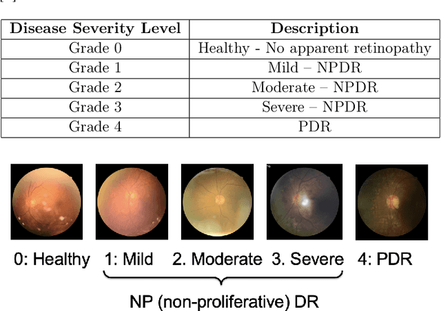 Figure 1 for MTCSNN: Multi-task Clinical Siamese Neural Network for Diabetic Retinopathy Severity Prediction