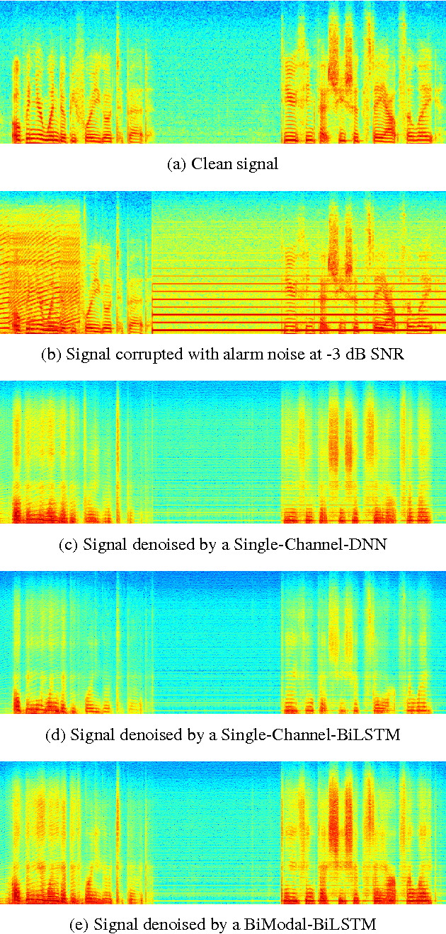Figure 4 for Multi-Modal Hybrid Deep Neural Network for Speech Enhancement