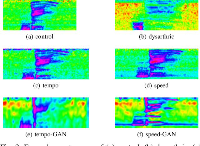 Figure 2 for Personalized Adversarial Data Augmentation for Dysarthric and Elderly Speech Recognition