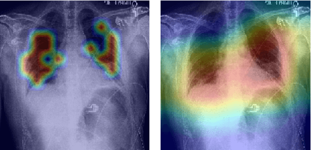 Figure 2 for Data-Efficient Vision Transformers for Multi-Label Disease Classification on Chest Radiographs
