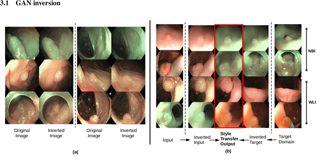 Figure 3 for GAN Inversion for Data Augmentation to Improve Colonoscopy Lesion Classification