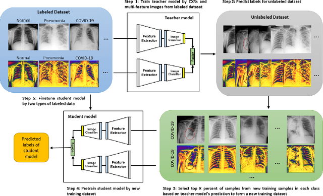Figure 3 for Multi-Feature Semi-Supervised Learning for COVID-19 Diagnosis from Chest X-ray Images