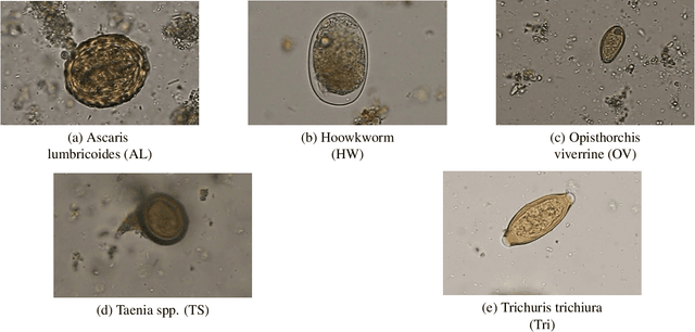 Figure 3 for Detection of Parasitic Eggs from Microscopy Images and the emergence of a new dataset