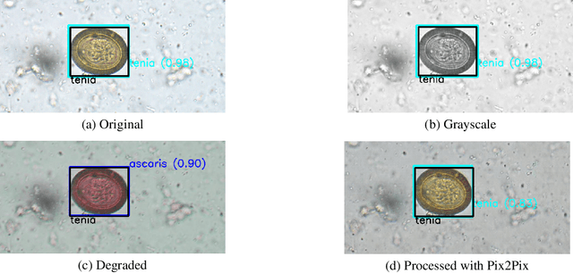 Figure 4 for Detection of Parasitic Eggs from Microscopy Images and the emergence of a new dataset