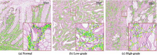 Figure 2 for CGC-Net: Cell Graph Convolutional Network for Grading of Colorectal Cancer Histology Images
