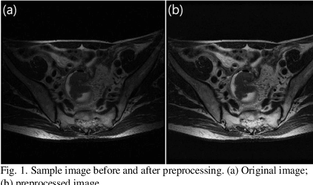 Figure 1 for Multi-Task Learning with a Fully Convolutional Network for Rectum and Rectal Cancer Segmentation