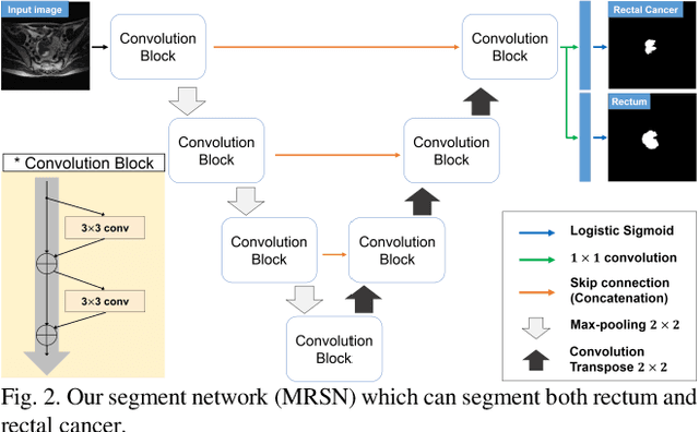 Figure 3 for Multi-Task Learning with a Fully Convolutional Network for Rectum and Rectal Cancer Segmentation