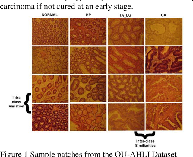 Figure 1 for Colorectal cancer diagnosis from histology images: A comparative study