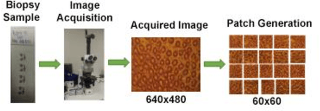 Figure 3 for Colorectal cancer diagnosis from histology images: A comparative study