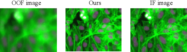 Figure 1 for Defocus Deblur Microscopy via feature interactive coarse-to-fine network