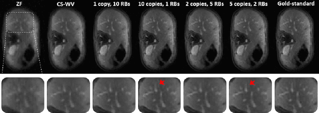 Figure 4 for Neural Proximal Gradient Descent for Compressive Imaging
