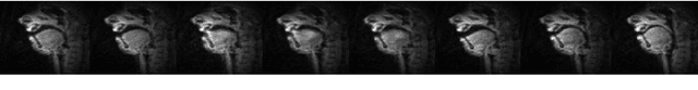 Figure 3 for Towards Automatic Speech Identification from Vocal Tract Shape Dynamics in Real-time MRI