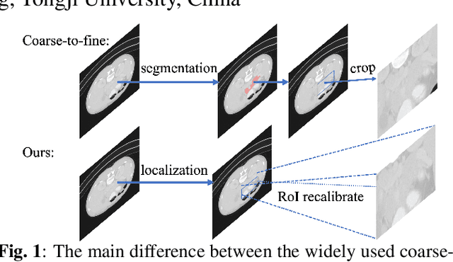 Figure 1 for L-SNet: from Region Localization to Scale Invariant Medical Image Segmentation