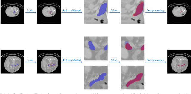 Figure 3 for L-SNet: from Region Localization to Scale Invariant Medical Image Segmentation