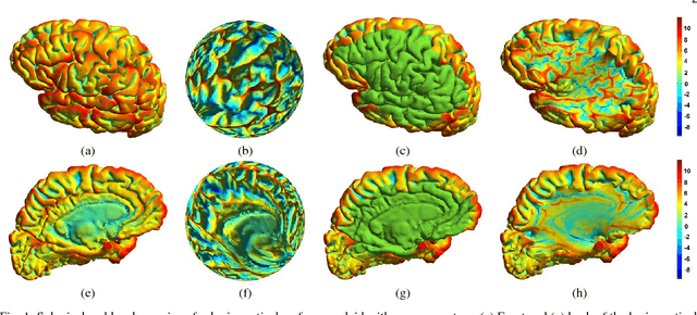 Figure 1 for LMap: Shape-Preserving Local Mappings for Biomedical Visualization