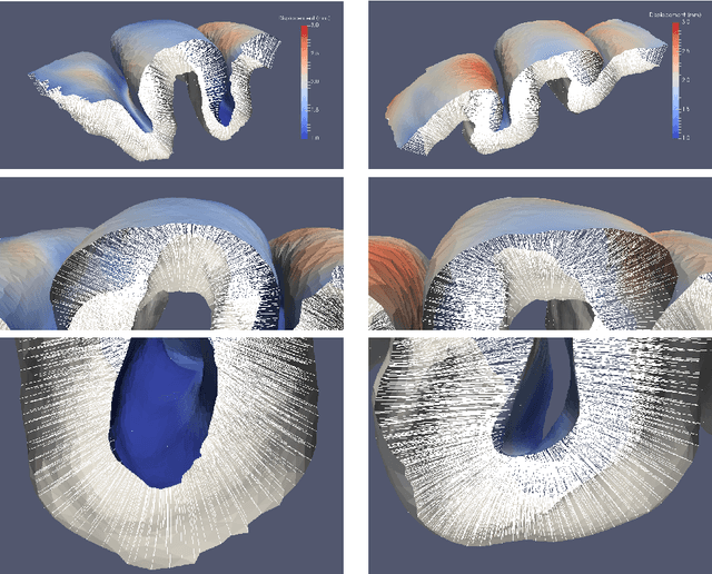 Figure 4 for 3D Normal Coordinate Systems for Cortical Areas