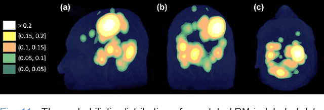 Figure 3 for Advancing Brain Metastases Detection in T1-Weighted Contrast-Enhanced 3D MRI using Noisy Student-based Training