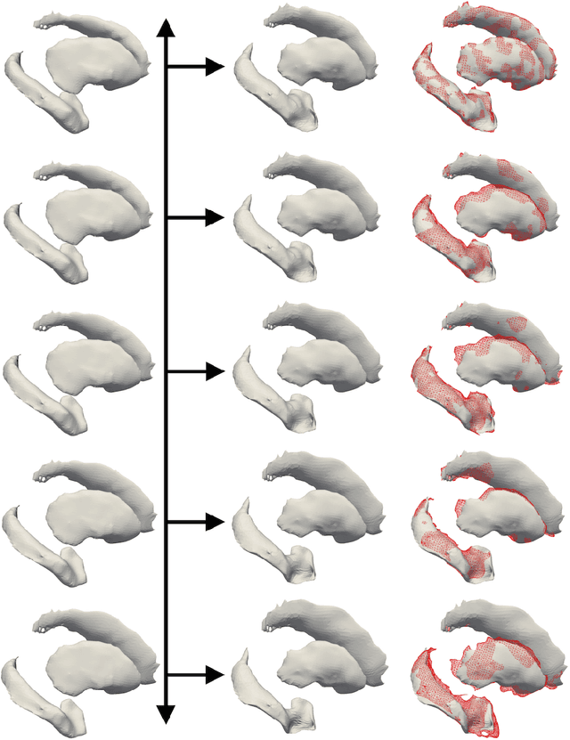 Figure 4 for Prediction of the progression of subcortical brain structures in Alzheimer's disease from baseline