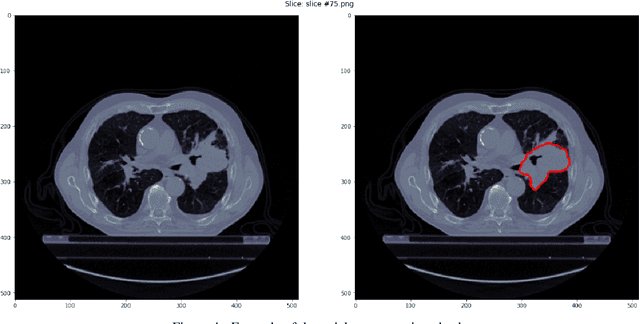 Figure 4 for Precision-medicine-toolbox: An open-source python package for facilitation of quantitative medical imaging and radiomics analysis