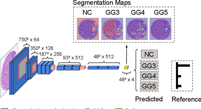 Figure 3 for WeGleNet: A Weakly-Supervised Convolutional Neural Network for the Semantic Segmentation of Gleason Grades in Prostate Histology Images