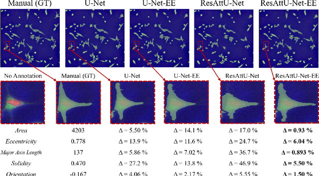 Figure 4 for Segmentation with Residual Attention U-Net and an Edge-Enhancement Approach Preserves Cell Shape Features