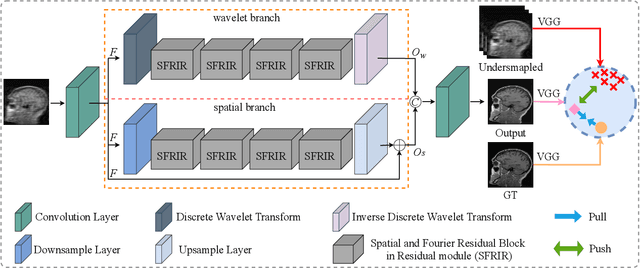 Figure 3 for Contrastive Learning for Local and Global Learning MRI Reconstruction