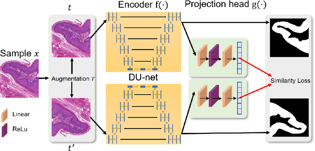 Figure 1 for DU-Net based Unsupervised Contrastive Learning for Cancer Segmentation in Histology Images