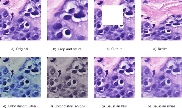 Figure 3 for DU-Net based Unsupervised Contrastive Learning for Cancer Segmentation in Histology Images
