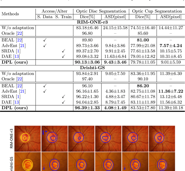 Figure 2 for Source-Free Domain Adaptive Fundus Image Segmentation with Denoised Pseudo-Labeling