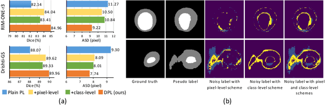 Figure 4 for Source-Free Domain Adaptive Fundus Image Segmentation with Denoised Pseudo-Labeling