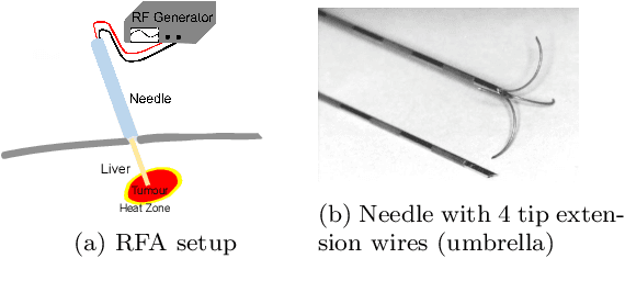 Figure 1 for Robust GPU-based Virtual Reality Simulation of Radio Frequency Ablations for Various Needle Geometries and Locations