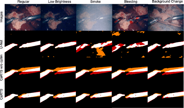Figure 1 for CaRTS: Causality-driven Robot Tool Segmentation from Vision and Kinematics Data